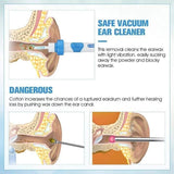 Ear Wax Remover Vacuum Cleaner