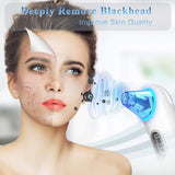 Blackhead Remover Pore Vacuum Extractor - pgraded Blue Light Blackhead Vacuum Pore Cleaner Electric Comedone Acne Extractor Kit Whitehead Black Head Removal Tool,LED Screen and 4 Porbes